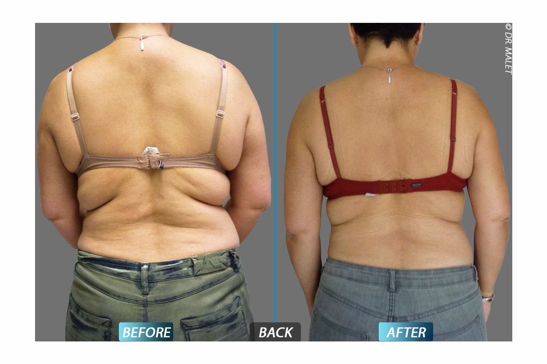 After image